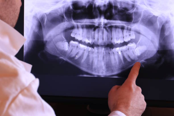 Best Emergency Dental Care for Broken or Chipped Teeth in Powder Springs, GA