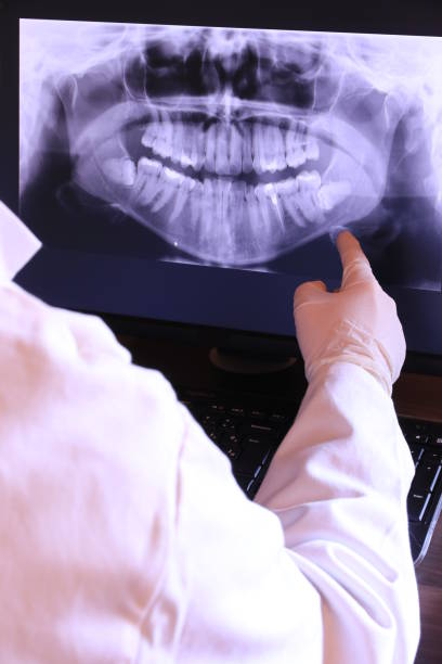 Best Emergency Treatment for Dental Infections or Abscesses in Powder Springs, GA