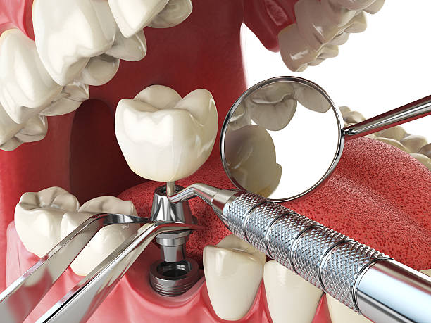 Best Emergency TMJ Treatment in Powder Springs, GA